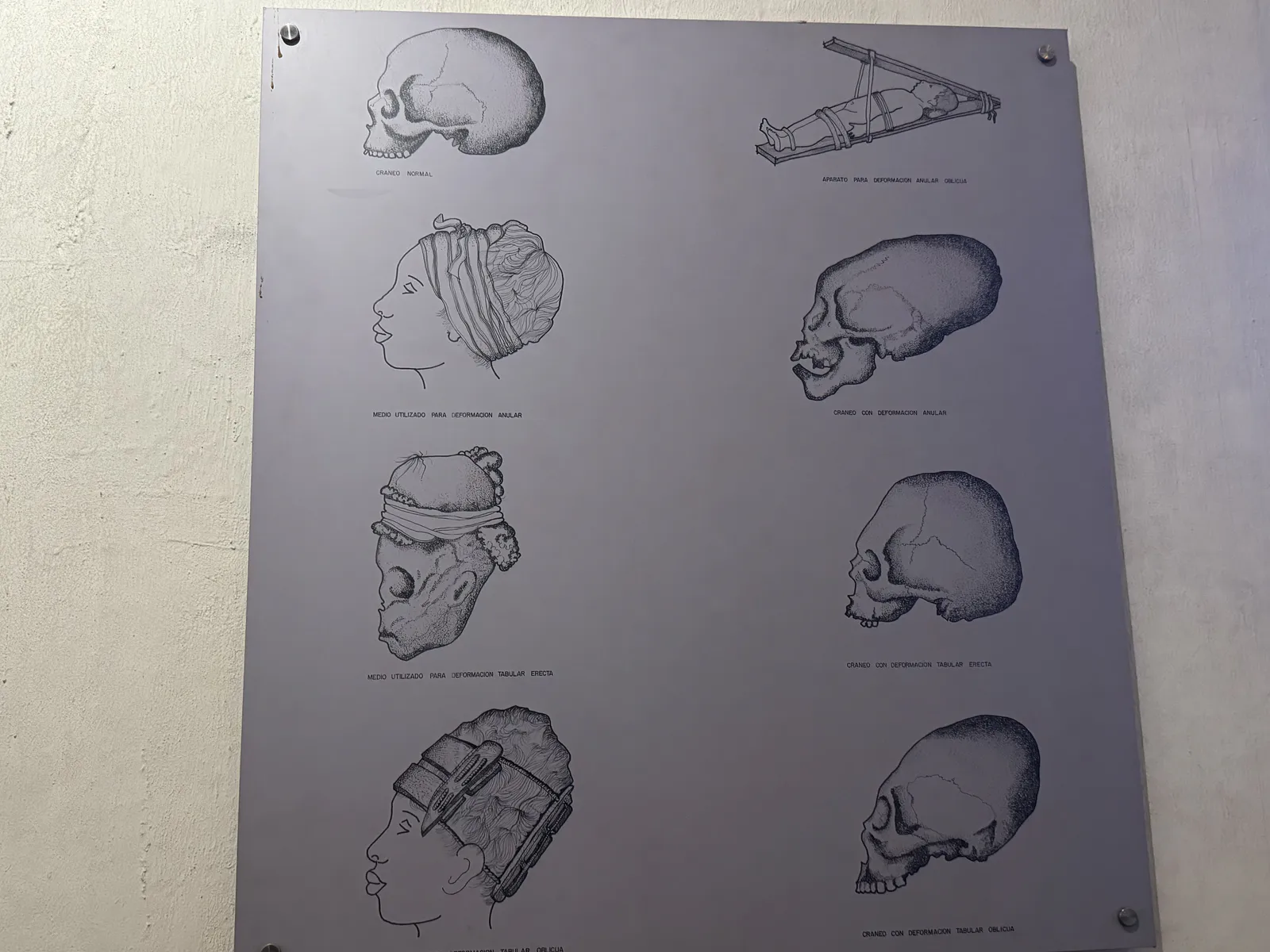 Pratiques de modification crânienne