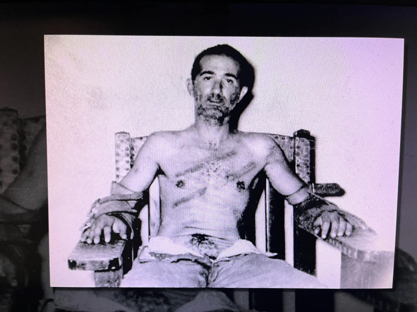 Miguel Álvarez Fadul After Torture
