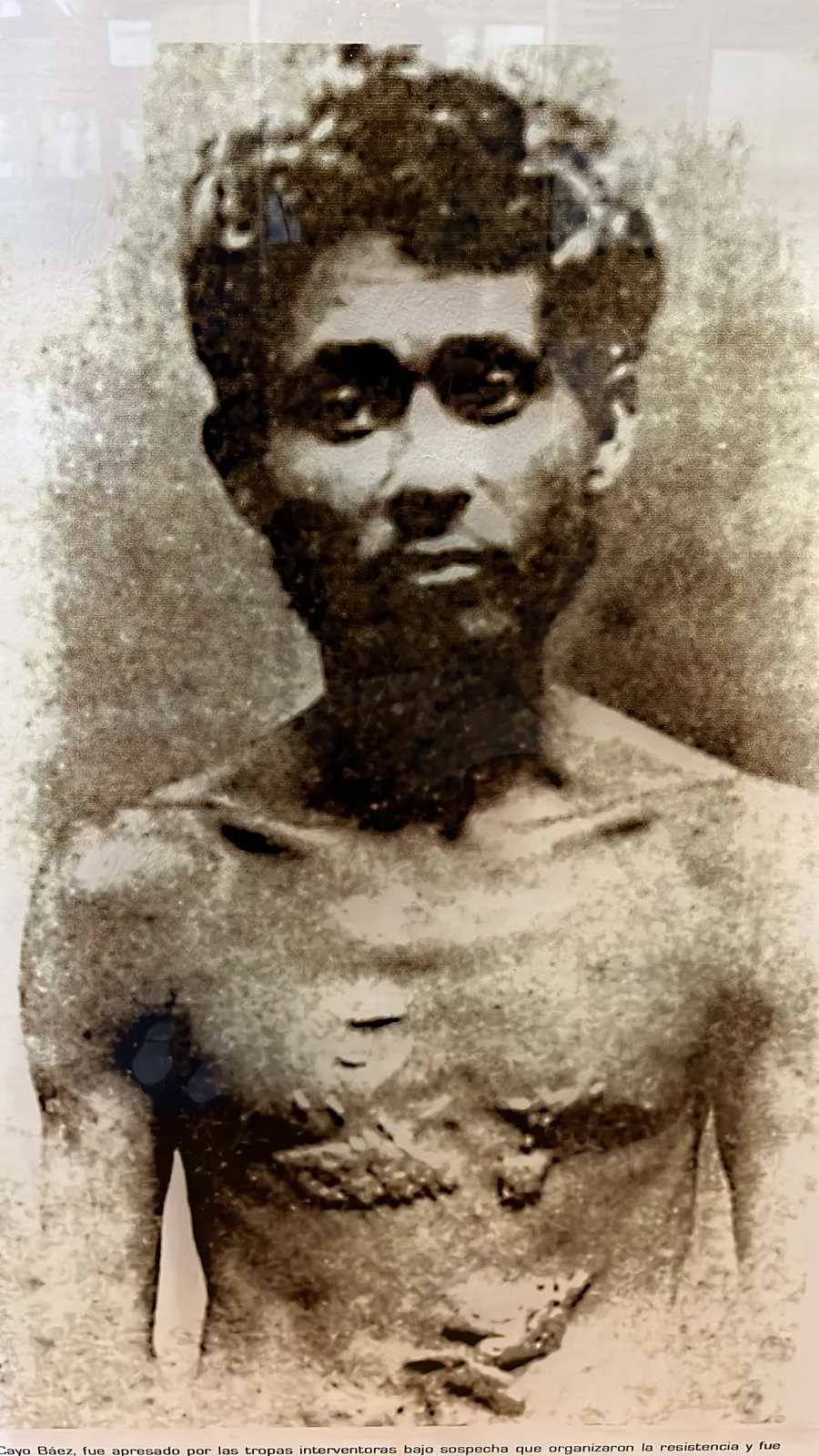 Cayo Báez after Torture